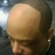 bad haircut